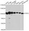 Poly(ADP-Ribose) Glycohydrolase antibody, A10577, ABclonal Technology, Western Blot image 