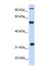 Apolipoprotein B MRNA Editing Enzyme Catalytic Subunit 1 antibody, NBP1-57268, Novus Biologicals, Western Blot image 
