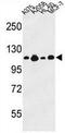 Bp180 antibody, AP51010PU-N, Origene, Western Blot image 