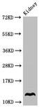 Oxytocin/Neurophysin I Prepropeptide antibody, CSB-PA017315LA01HU, Cusabio, Western Blot image 