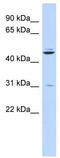 Zinc Finger And BTB Domain Containing 18 antibody, TA339128, Origene, Western Blot image 