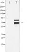 Calcium/Calmodulin Dependent Protein Kinase II Beta antibody, TA325290, Origene, Western Blot image 