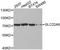 Solute carrier family 22 member 8 antibody, A3119, ABclonal Technology, Western Blot image 