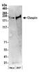 Claspin antibody, A300-265A, Bethyl Labs, Western Blot image 
