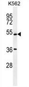 UDP-N-Acetylglucosamine Pyrophosphorylase 1 Like 1 antibody, AP54433PU-N, Origene, Western Blot image 