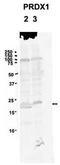 Peroxiredoxin 1 antibody, TA346666, Origene, Western Blot image 