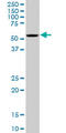 Oxidative Stress Responsive Kinase 1 antibody, LS-C133614, Lifespan Biosciences, Western Blot image 