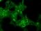 Cyclin Dependent Kinase Inhibitor 2A antibody, NBP2-45602, Novus Biologicals, Immunofluorescence image 