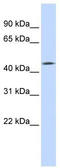 Transmembrane Protein With EGF Like And Two Follistatin Like Domains 1 antibody, TA338218, Origene, Western Blot image 