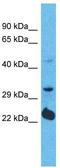 Olfactory Receptor Family 5 Subfamily D Member 14 antibody, TA337523, Origene, Western Blot image 