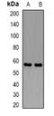 PDZ Domain Containing 1 antibody, abx141727, Abbexa, Western Blot image 