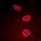 Desmocollin 1 antibody, orb101537, Biorbyt, Immunofluorescence image 