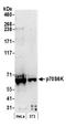 Ribosomal Protein S6 Kinase B1 antibody, A300-510A, Bethyl Labs, Western Blot image 