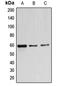 Beta-1,4 N-acetylgalactosaminyltransferase 1 antibody, LS-C352227, Lifespan Biosciences, Western Blot image 