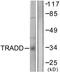 TNFRSF1A Associated Via Death Domain antibody, TA312115, Origene, Western Blot image 