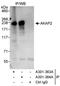 A-Kinase Anchoring Protein 2 antibody, A301-364A, Bethyl Labs, Immunoprecipitation image 
