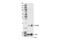Cyclin Dependent Kinase Inhibitor 2B antibody, 36303S, Cell Signaling Technology, Western Blot image 