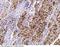 Fatty Acid Binding Protein 4 antibody, 12109-R001, Sino Biological, Immunohistochemistry paraffin image 