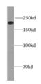 Protein unc-13 homolog A antibody, FNab09255, FineTest, Western Blot image 