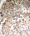 Protein Tyrosine Phosphatase Non-Receptor Type 6 antibody, TA333281, Origene, Immunohistochemistry frozen image 