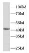 F-Box Protein 28 antibody, FNab03042, FineTest, Western Blot image 