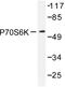 Ribosomal Protein S6 Kinase B1 antibody, AP06552PU-N, Origene, Western Blot image 