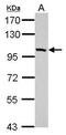 Dual 3 ,5 -cyclic-AMP and -GMP phosphodiesterase 11A antibody, GTX110015, GeneTex, Western Blot image 