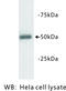 Tubulin Beta 3 Class III antibody, MBS355132, MyBioSource, Western Blot image 