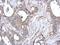 S100 Calcium Binding Protein A10 antibody, GTX100697, GeneTex, Immunohistochemistry paraffin image 