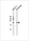 Adenine Phosphoribosyltransferase antibody, LS-B9158, Lifespan Biosciences, Western Blot image 