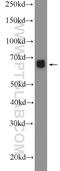 Erythropoietin Receptor antibody, 55308-1-AP, Proteintech Group, Western Blot image 