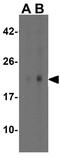 Ras antibody, GTX31543, GeneTex, Western Blot image 