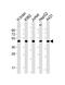 Tumor Susceptibility 101 antibody, M01233-1, Boster Biological Technology, Western Blot image 