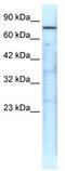 Putative endoplasmin-like protein antibody, TA330313, Origene, Western Blot image 