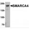 SWI/SNF Related, Matrix Associated, Actin Dependent Regulator Of Chromatin, Subfamily A, Member 4 antibody, TA349038, Origene, Western Blot image 