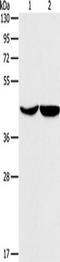 Asporin antibody, TA350950, Origene, Western Blot image 
