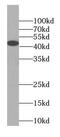 KiSS-1 receptor antibody, FNab04593, FineTest, Western Blot image 