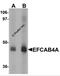Calcium Release Activated Channel Regulator 2B antibody, 6043, ProSci, Western Blot image 