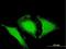 OPTN antibody, H00010133-B01P, Novus Biologicals, Immunocytochemistry image 