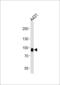 Desmocollin 3 antibody, LS-B9474, Lifespan Biosciences, Western Blot image 
