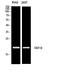 Ubiquitin D antibody, STJ97631, St John