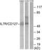 Interleukin 7 Receptor antibody, A30449, Boster Biological Technology, Western Blot image 
