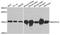 NADH:Ubiquinone Oxidoreductase Subunit A12 antibody, A8237, ABclonal Technology, Western Blot image 