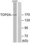 DNA topoisomerase 2-alpha antibody, TA313203, Origene, Western Blot image 