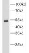 Endothelin Receptor Type B antibody, FNab02637, FineTest, Western Blot image 