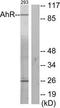 Aryl Hydrocarbon Receptor antibody, TA313162, Origene, Western Blot image 