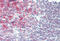CD20 antibody, MBS249063, MyBioSource, Immunohistochemistry paraffin image 