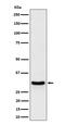 FRAT Regulator Of WNT Signaling Pathway 1 antibody, M08049, Boster Biological Technology, Western Blot image 