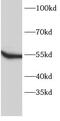 FYN Proto-Oncogene, Src Family Tyrosine Kinase antibody, FNab10273, FineTest, Western Blot image 