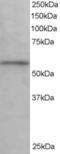 Karyopherin Subunit Alpha 3 antibody, EB06237, Everest Biotech, Western Blot image 